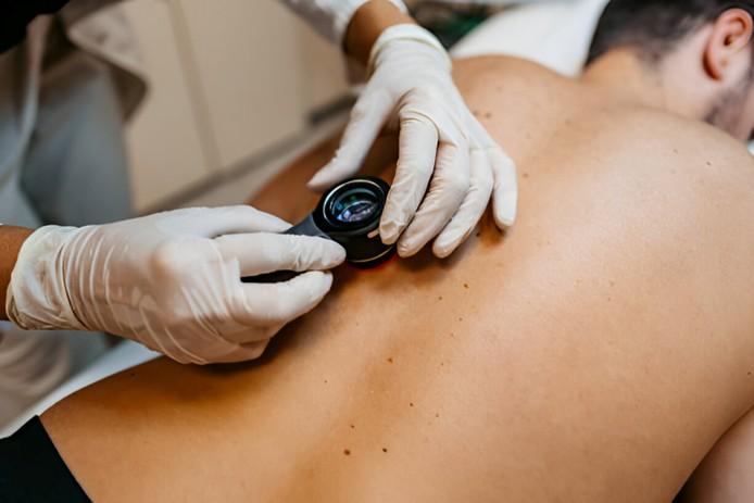 10 Life-Saving Reasons to Get a Skin Cancer Check