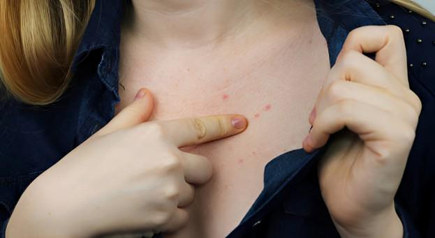 Dangerous Skin Changes You Should Never Ignore