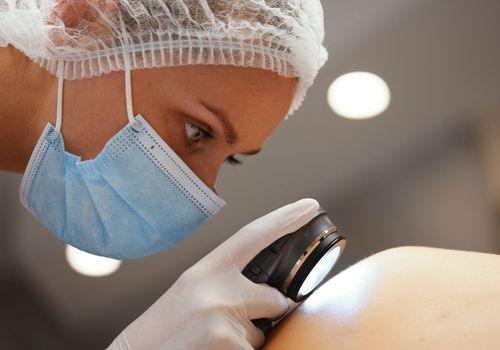Doctor using a dermatoscope to examine a mole during a skin cancer check